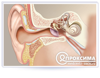 Продувание слуховых труб по Политцеру в домашних условиях - самопродувание евстахиевой, что это такое и как делать продувку ушей, можно ли ребенку