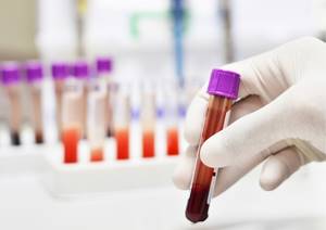 PLT в анализе крови: что это такое, норма и отклонения у женщин и мужчин, диагностика и лечение