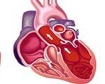 Инфекционно-токсическая кардиопатия: что это такое и как с ней бороться