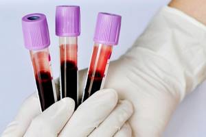 АЛТ анализ крови: что это такое, норма показателя, расшифровка, как сдавать