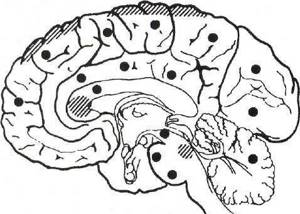 Диффузное аксональное повреждение головного мозга: причины, симптомы, лечение, последствия, прогноз
