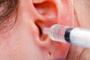 Можно ли перекисью водорода чистить уши самостоятельно в домашних условиях