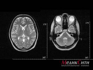 Черепно-мозговая травма (ЧМТ), травмы головы: причины, виды, признаки, помощь, лечение