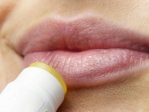 Почему сохнут губы: причины сухости губ у женщин, признаки заболеваний, лечение