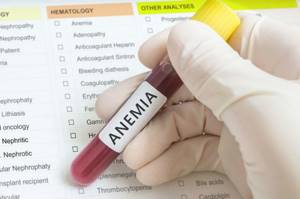 Анемия: причины и виды, признаки и проявления, как лечить