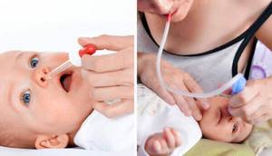 Как промывать нос физраствором ребенку: можно ли и как правильно, промывание хлоридом натрия шприцом