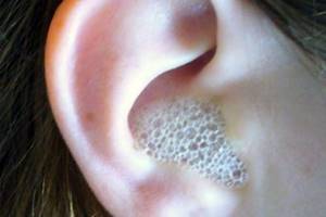 Перекись водорода в ухо: применение, лечение при боли и заложенности