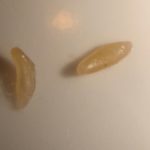 Могут ли быть в сырой или соленой селедке глисты: разбираем признаки