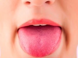 Что делать при ожоге языка: горячим кипятком, химическом - как лечить и снять боль