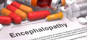 ДЭП (дисциркуляторная энцефалопатия) - понятие, как развивается, проявления, степени и лечение