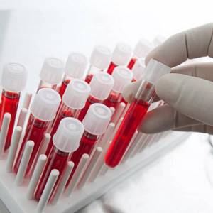 Анализ крови RW: расшифровка результата, что значит исследование