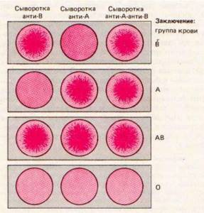 Определение группы крови цоликлонами - что это и как проводится