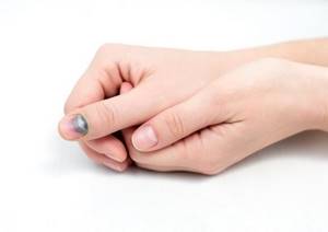 Ушиб пальца на руке: чем лечить, симптомы и последствия