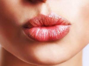 Почему сохнут губы: причины сухости губ у женщин, признаки заболеваний, лечение