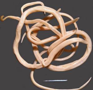 Скребни черви: чем опасны для человека и какие у них симптомы