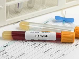 PSA (простатспецифический антиген): понятие, норма в анализе, тактика и прогноз исходя из уровня, правила сдачи