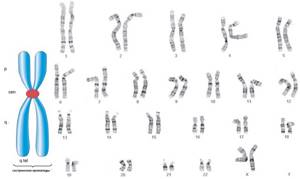 Кариотип человека: что такое, определение кариотипа, хромосомы