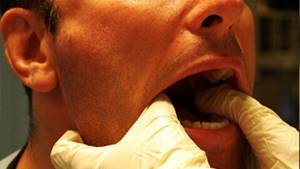 Вывих нижней челюсти: симптомы, лечение, как вправить челюсть в домашних условиях