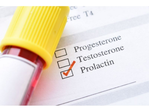 На какой день цикла сдавать пролактин и прогестерон: когда лучше сдается женщине анализ гормона