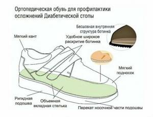 Обувь для диабетиков, выбор диабетической обуви для женщин и мужчин