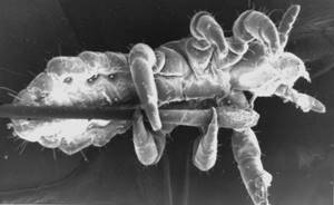 Как избавиться от вшей и гнид – 35 способов борьбы с паразитами
