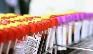 Биохимический анализ крови: нормы у взрослых и детей, показатели, как расшифровать результаты