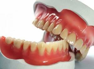 Культевая вкладка для зубов под коронку при протезировании: что это такое, виды, сколько стоит, установка