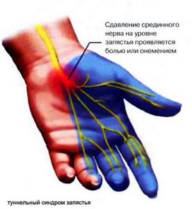 Болит большой палец на руке в суставе: список причин и методов лечения