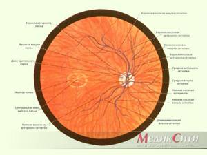 Гипертоническая ангиопатия сетчатки глаза: причины, лечение