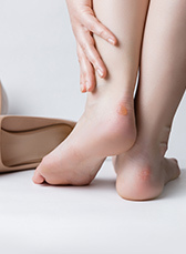 Натоптыши на ногах: лечение и удаление, фото, как избавиться в домашних условиях