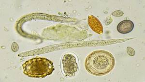 Как выглядят яйца глистов в кале у детей: симптомы и лечение различных видов паразитов