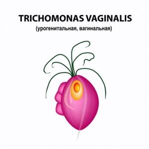 Трихомониаз инкубационный — Инкубационный период трихомониаза, симптомы