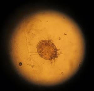 Кожные паразиты у человека: фото кожных заболеваний, основные причины и методы лечения