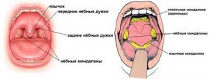 Белые точки на миндалинах и гландах в горле у детей и взрослых, лечение белых образований