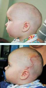 Форма головы у новорожденных: норма и отклонения (фото)