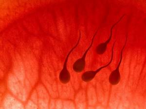 Кровь в сперме: почему, причины, лечение, что означает