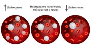 Норма лейкоцитов в крови по возрастам, типы клеток, причины отклонений и дополнительные обследования