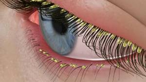 Демодекоз на глазах: лучшие препараты для лечения