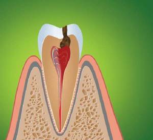 Сколько каналов и нервов в зубах человека, таблица
