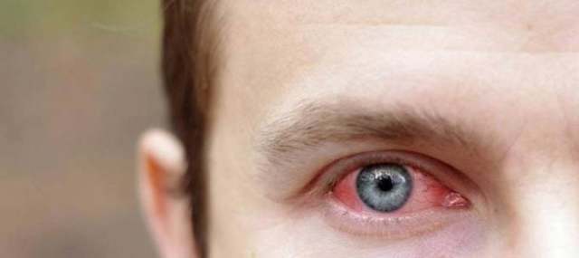 Кровоизлияние в глазу: причины и виды, методы лечения и прогноз сохранения зрения