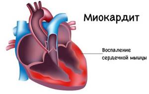 Где находится сердце у человека: с какой стороны расположено в грудной клетке в норме и возможные отклонения