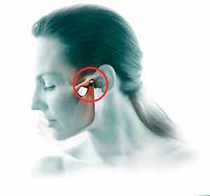 Щелкает в ухе: причины и лечение, почему трещит и щелчки, хруст и скрипит при движении челюстью при глотании, что делать, если потрескивание