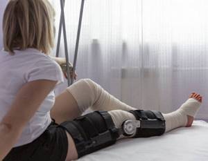Зачем нужна лангетка на ногу при травме: разновидности, критерии выбора, противопоказания
