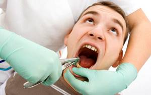 Нужно ли пить антибиотики после удаления зуба, какие принимать после удаления зуба мудрости