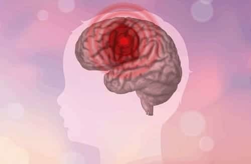 Что это такое эписиндром и как проявляется симптоматическая эпилепсия: симптомы и лечение