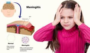 Профилактика менингита у детей и взрослых: образ жизни, вакцинация, как предупредить болезнь