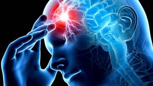 Острое нарушение мозгового кровообращения (ОНМК): что это такое, симптомы, лечение, последствия и прогноз
