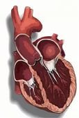 Что такое кардиомиопатия, классификация и симптомы, лечение и прогноз жизни
