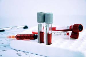 Лимфоциты в крови: норма у взрослых и детей, причины повышения и понижения