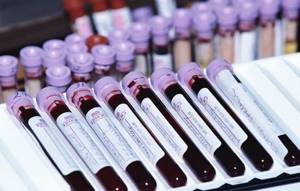 Как узнать группу крови: где определить свою, резус-фактор в домашних условиях, без анализов